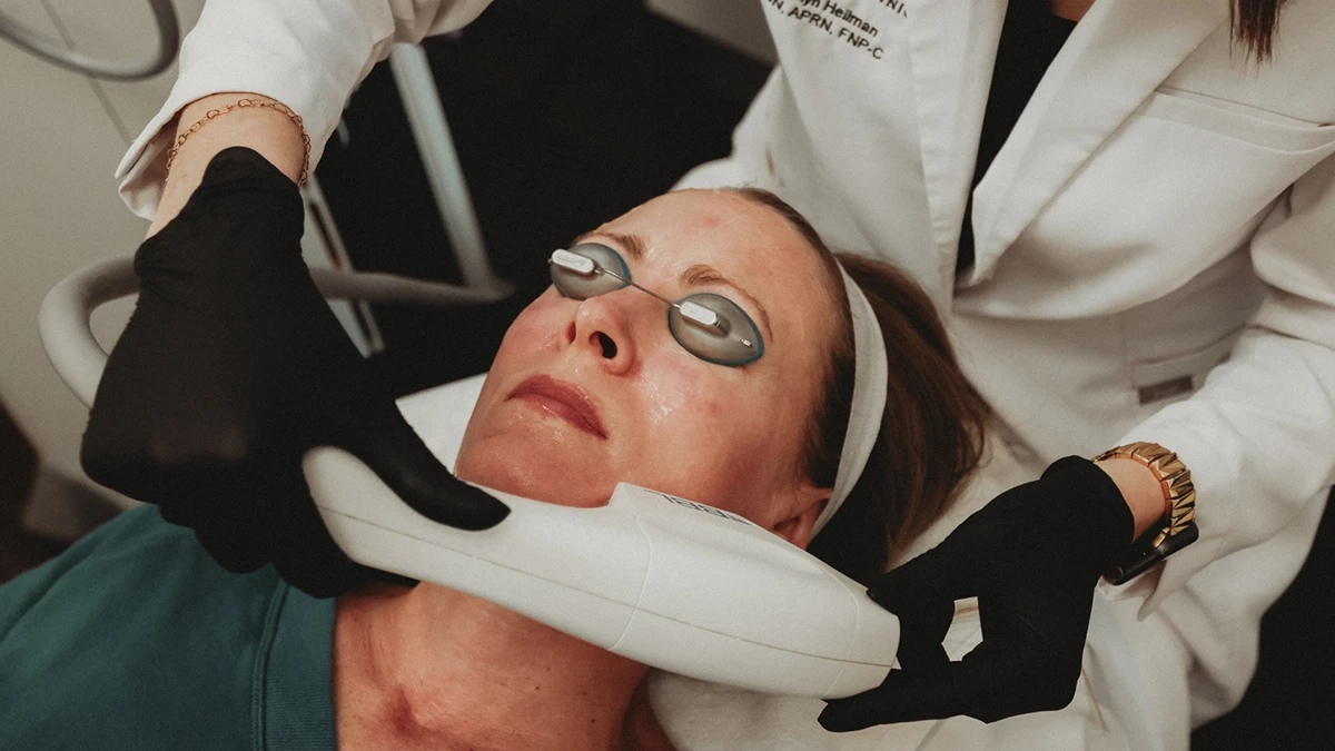 BBL Hero™ for Supporting Collagen Production in Powell, Ohio
