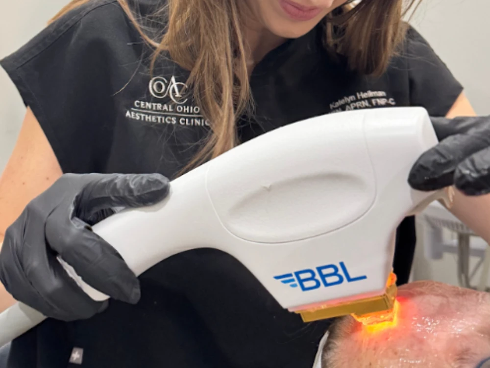 A woman in a black uniform performs a skin treatment using a BBL device on a patient's forehead. She wears black gloves, conveying a clinical setting. A woman in a black uniform performs a skin treatment using a BBL device on a patient's forehead. She wears black gloves, conveying a clinical setting.