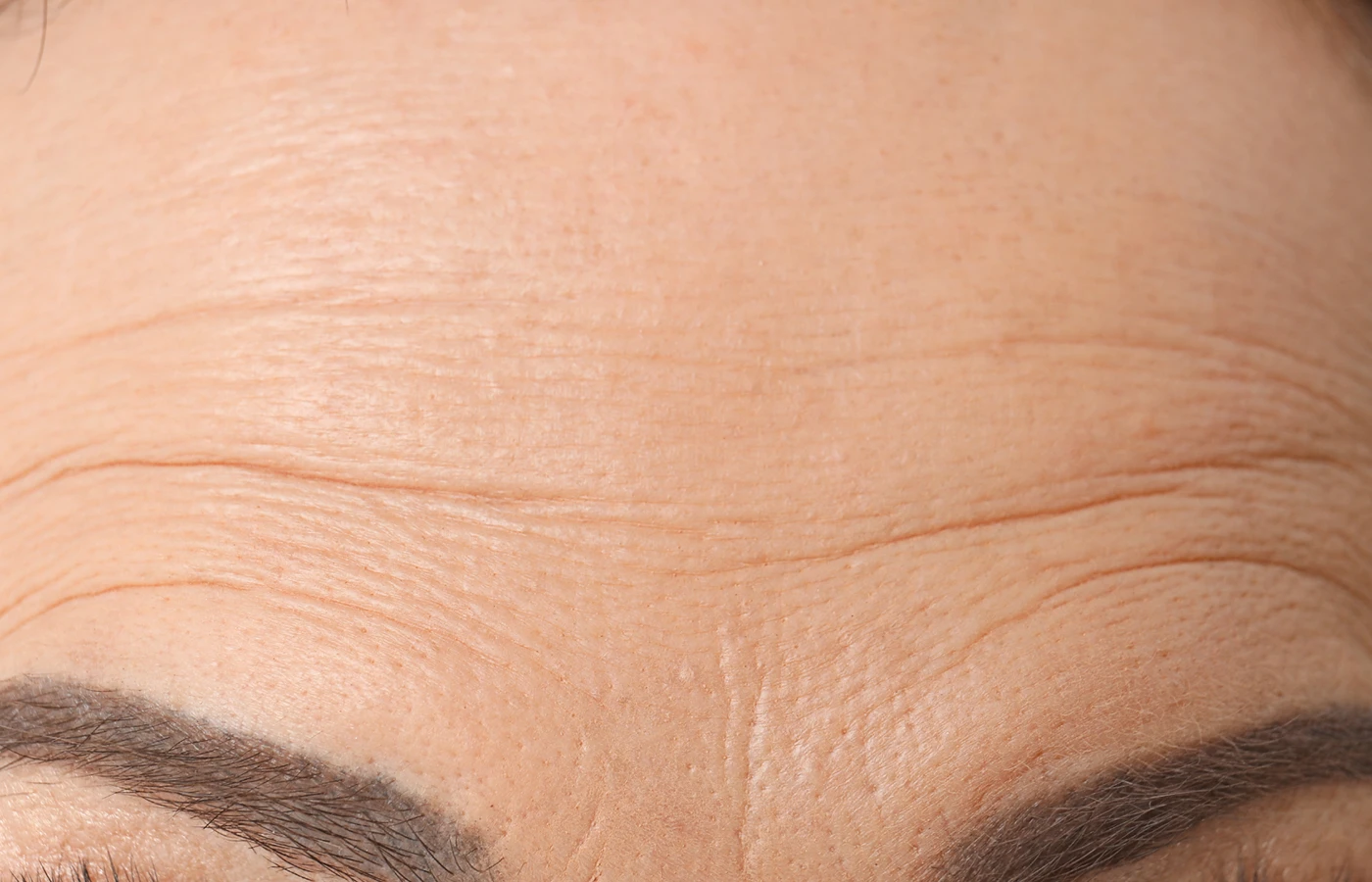 Forehead Wrinkles Treatment in Powell, OH