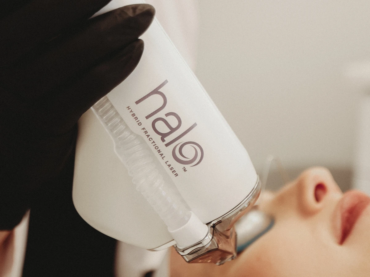 HALO™ Laser Treatment in Powell, OH