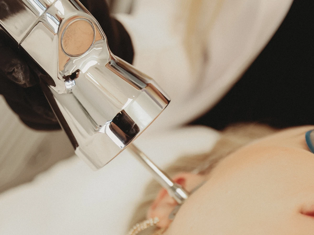 Laser Skin Resurfacing in Powell, OH