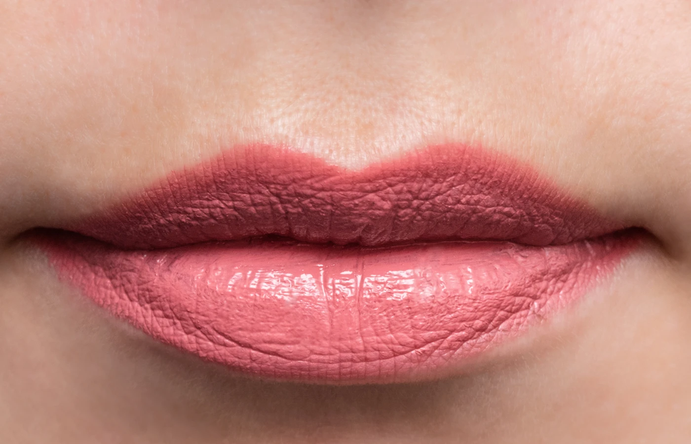 Lip Filler Treatment in Powell, Oh