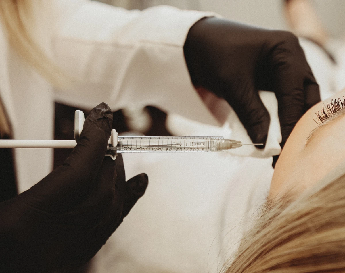 Marionette Lines - Sculptra® in Powell, OH