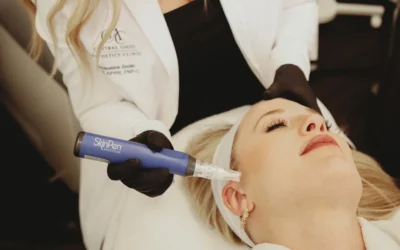Microneedling Benefits for Smoother, Healthier Skin in Powell, Ohio