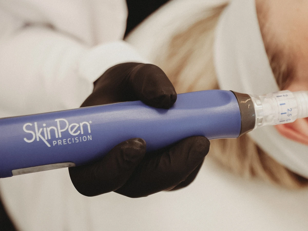 Microneedling in Powell, OH
