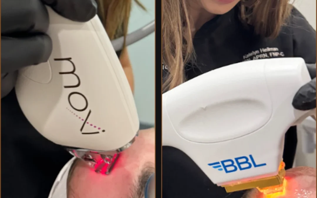 Moxi™ vs BBL®: Which Laser Treatment is Right for You in Powell, OH?