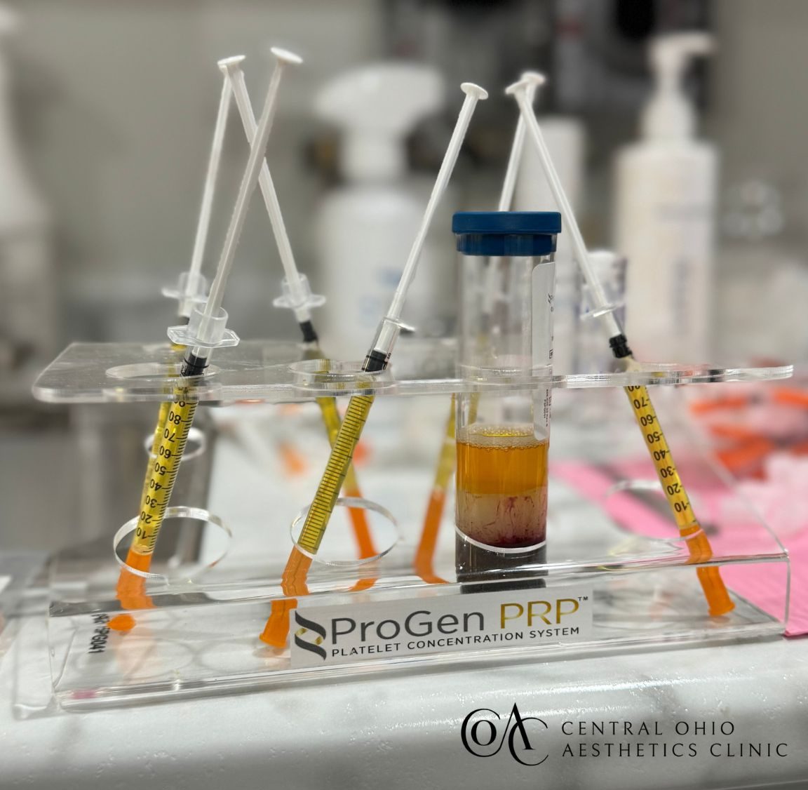PRP Treatment