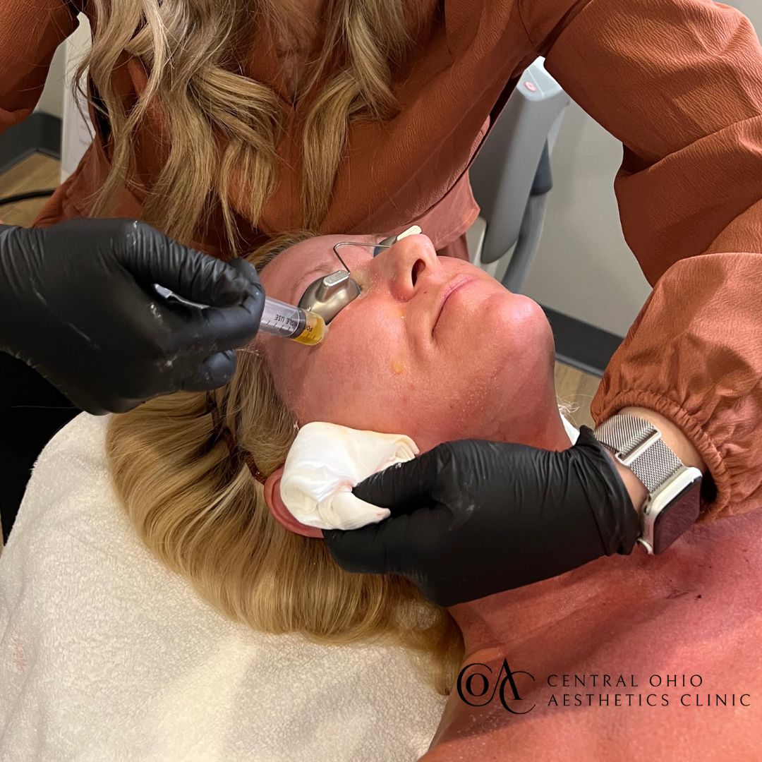 A person receives a facial treatment at a clinic, lying down with protective eyewear. A practitioner, in gloves, uses a syringe. Calm setting.