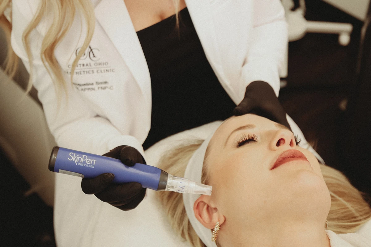 Woman receiving SkinPen microneedling treatment at Central Ohio Aesthetics Clinic
