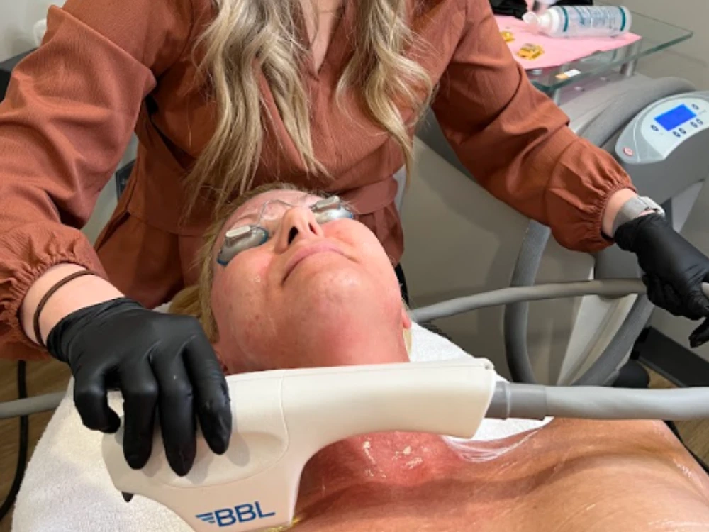 A woman receives a beauty treatment using a BBL device in a clinic. She wears protective goggles. The technician is holding the device, wearing black gloves. A woman receives a beauty treatment using a BBL device in a clinic. She wears protective goggles. The technician is holding the device, wearing black gloves.