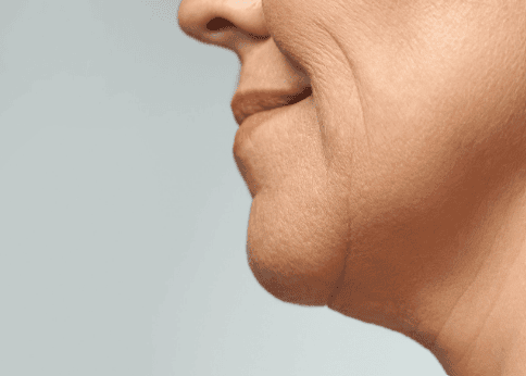 A woman with a small neck poses, showcasing her delicate features and elegant appearance.