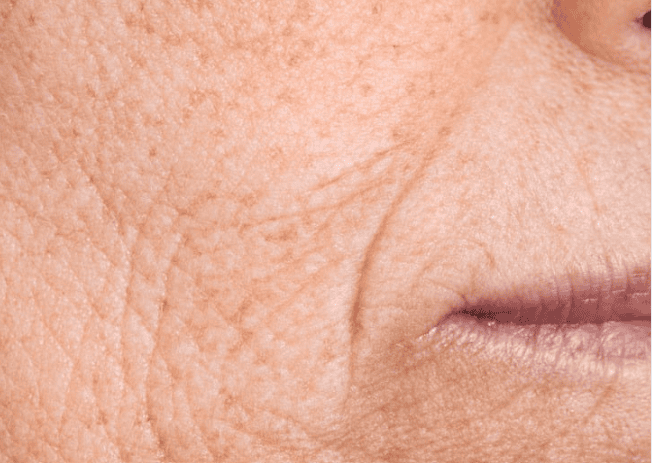 A close-up of an older woman's face, highlighting her wrinkles and the wisdom reflected in her expression.