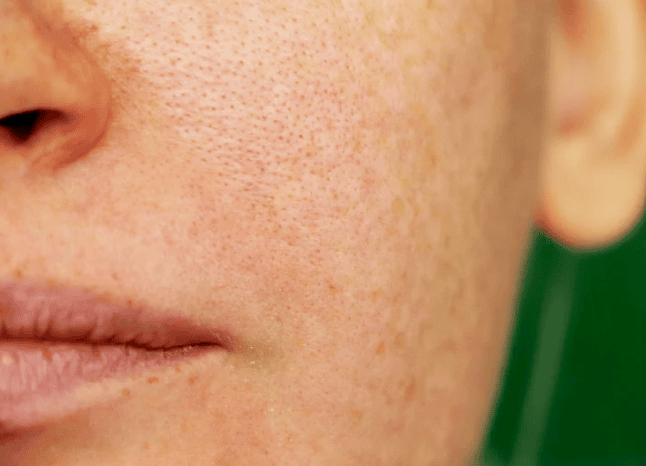 A close-up of a woman's face showcasing her freckles and natural beauty.