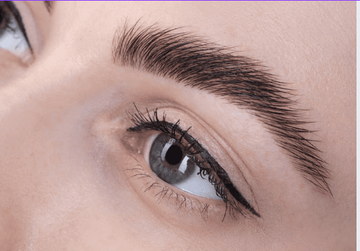 Brow lift
