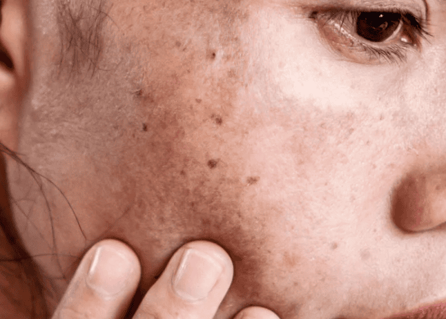 A woman with freckles on her face, smiling softly, showcasing her natural beauty and warm expression.